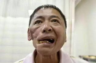 吃拉瓜脸会黑吗怎么回事,“吃拉瓜脸会黑？揭秘食物与肤色变化的神秘关系”
